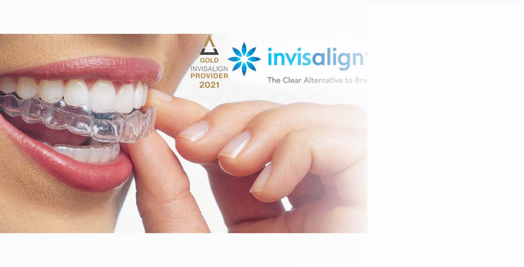 Invisalign Discount