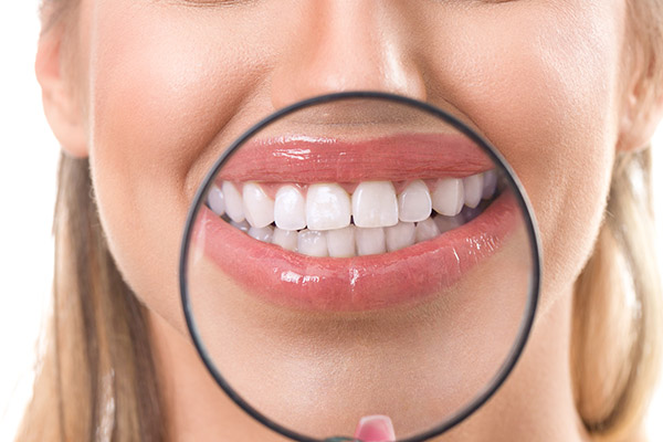 Can A Smile Makeover Correct Dental Imperfections?