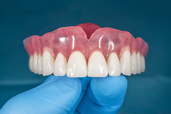 Caring for Your Dentures from Allure Dentistry in Los Angeles, CA