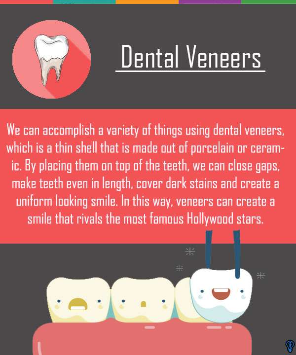 You Can Have A Perfect Smile With Dental Veneers