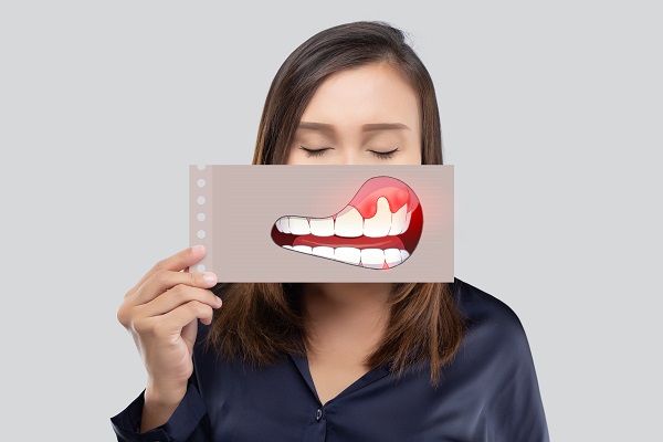 Routine Dental Checkups Can Help Prevent Gum Disease