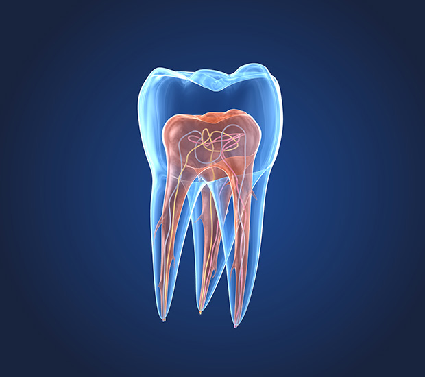 Los Angeles What is an Endodontist